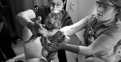 Child Birth Photography Monash Medical Centre Melbourne