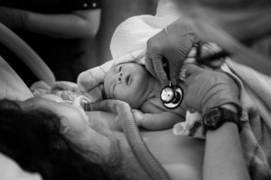 Child Birth Photography monitoring newborn