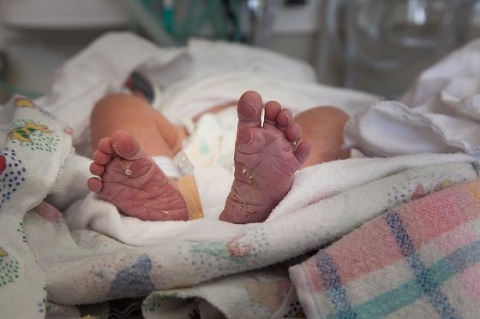 Child Birth Photography Melbourne overdue baby wrinkle feet