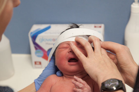 Measuring head circumference of newborn monash medical centre